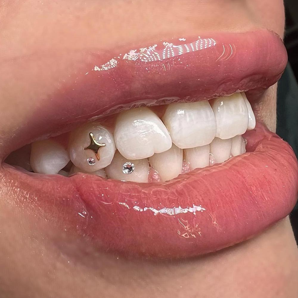 Teeth Gems