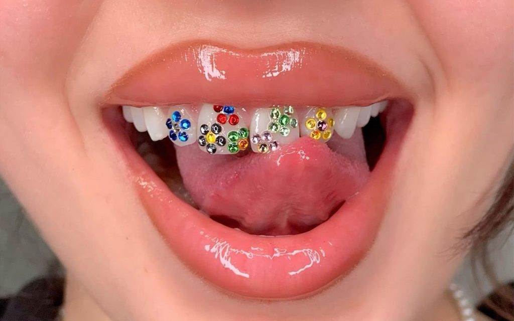do tooth gems ruin your teeth